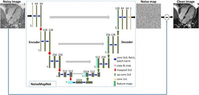 Fast reconstruction of SMS bSSFP myocardial perfusion images using noise map estimation network (NoiseMapNet): a head-to-head comparison with parallel imaging and iterative reconstruction